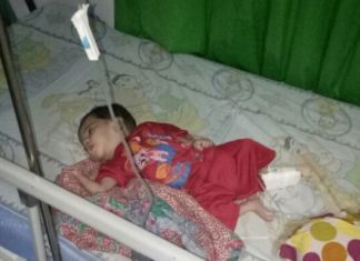 Di Mamuju, Ahmad Terbaring Akibat Gizi Buruk