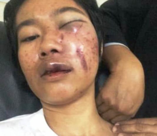 Desi Dihadang di Jalan, Ditarik, Dicekik Lalu Dipukul Tiga Pemuda di Mateng