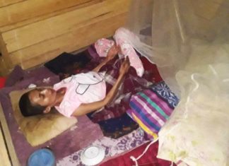 4 Tahun Nurhayati Terbaring Sakit di Tapalang, Ibrahim: Nanti Kami Bantu