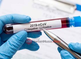 Pasien 02 Inisial A (25) Positif Terjangkit Virus COVID-19 adalah Warga Mamuju